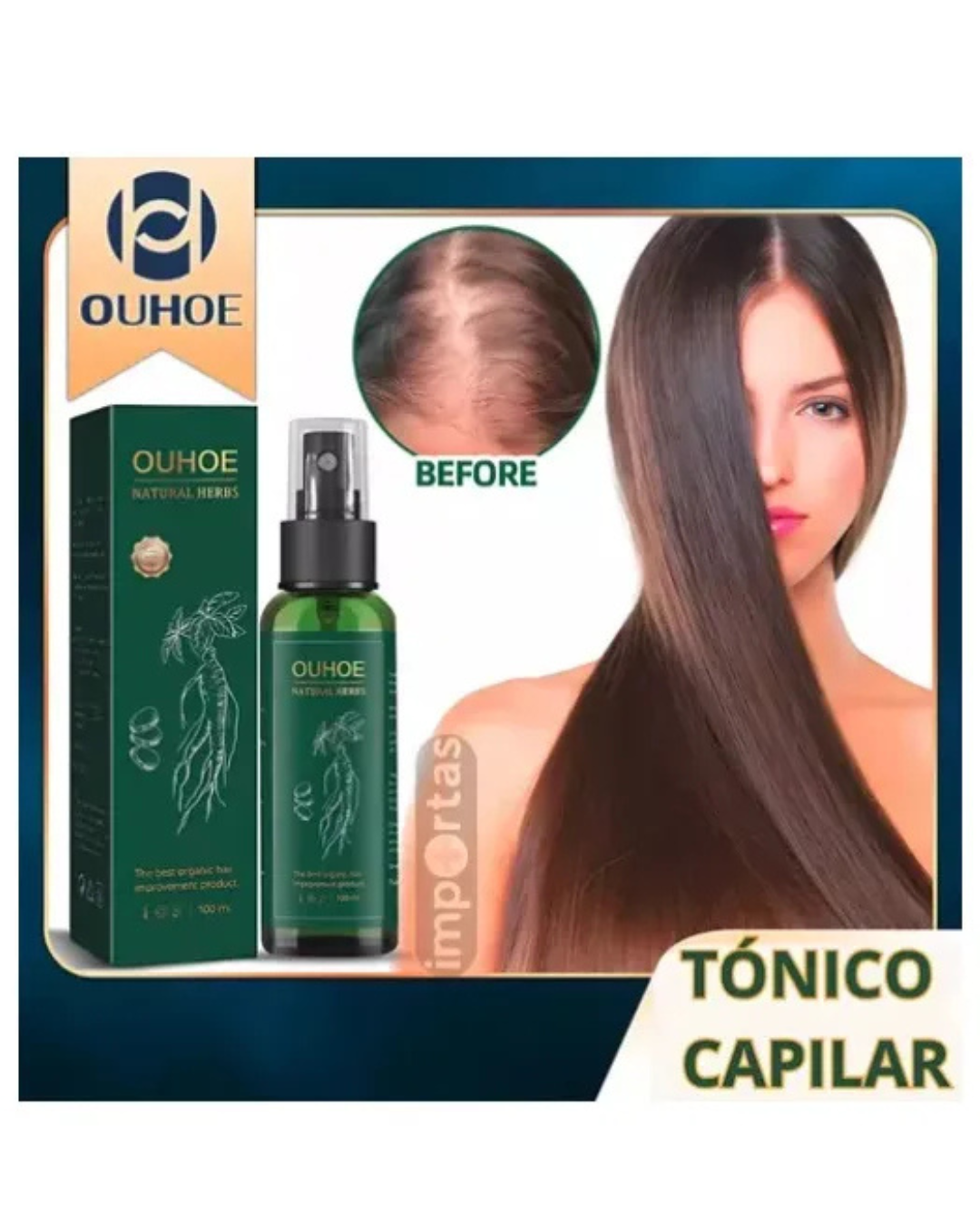 OUHOE - SERUM CRECIMIENTO DE CABELLO