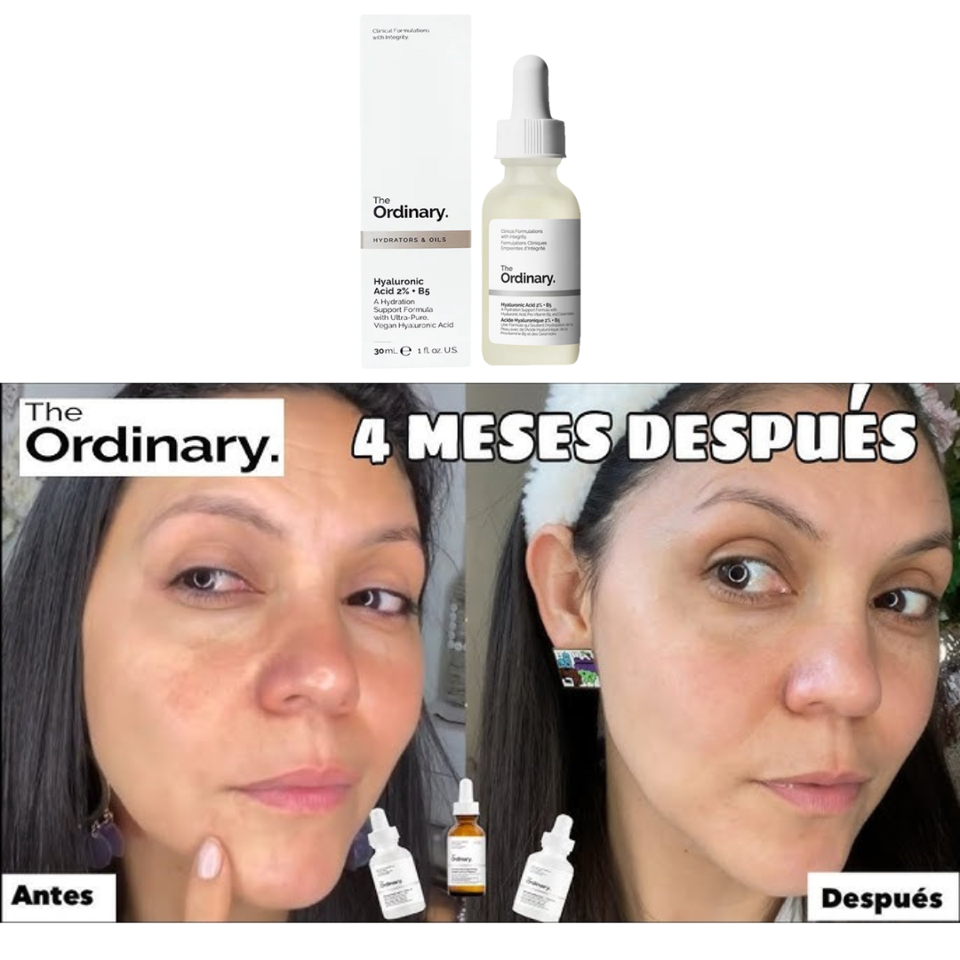 SUERO DE ACIDO HIALURONICO THE ORDINARY
